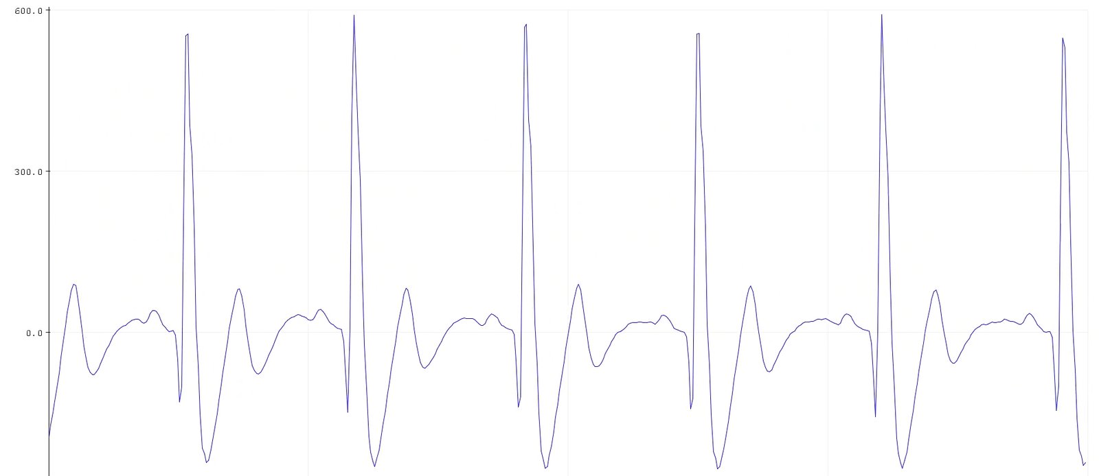 ../../../_images/bioamp-Exg-Pill-ECG1.jpg