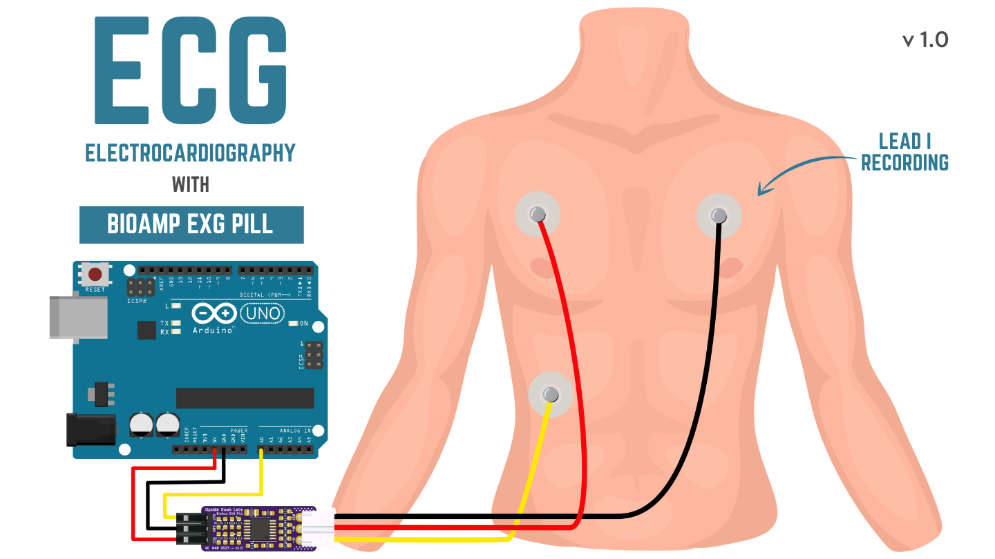 ../../../_images/ecg.png