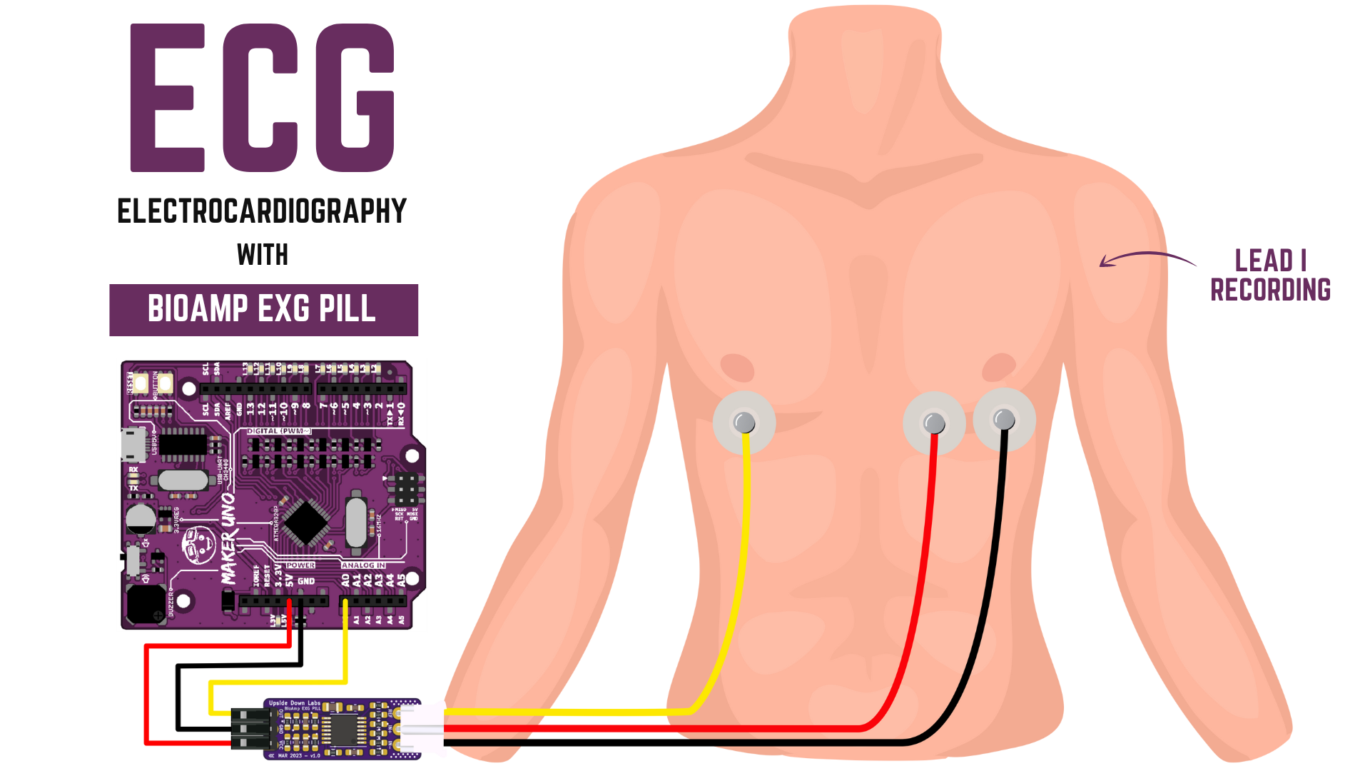 ../../../_images/ecg1.png