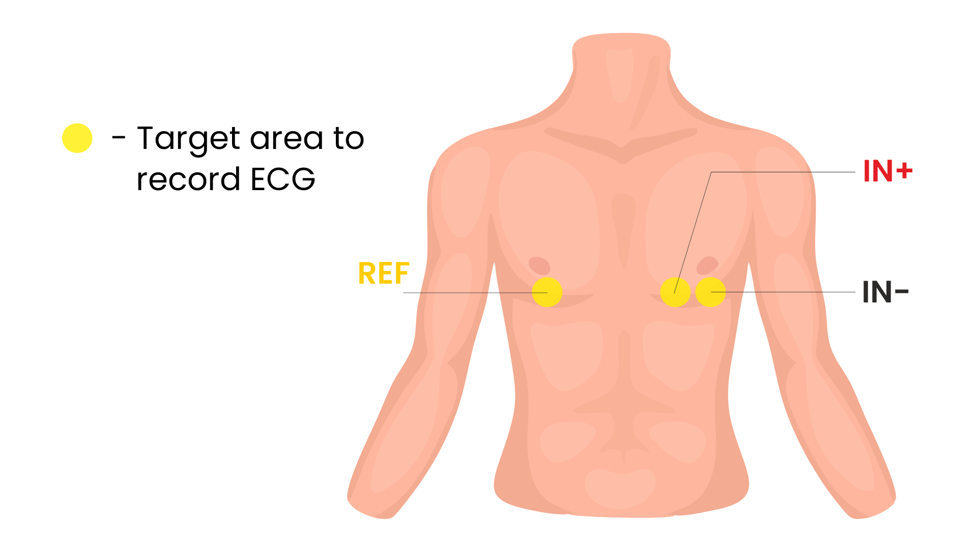 ../../../_images/skin-prep-ecg.png