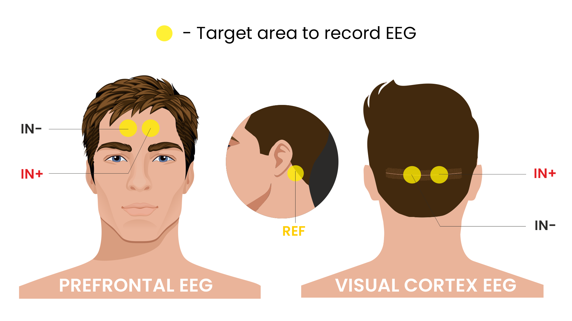 ../../../_images/skin-prep-eeg.png